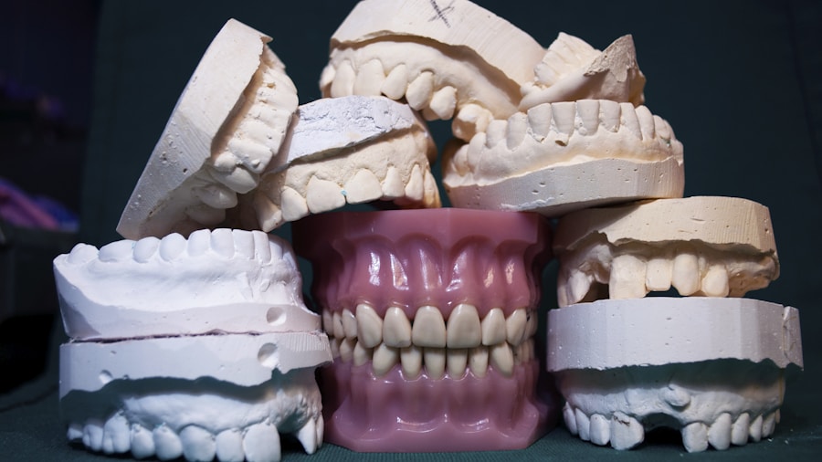 Daybreak Joins National ePrescribing Platform: What Sleep Apnea Shoppers Should Know 2 custom dental impression kit