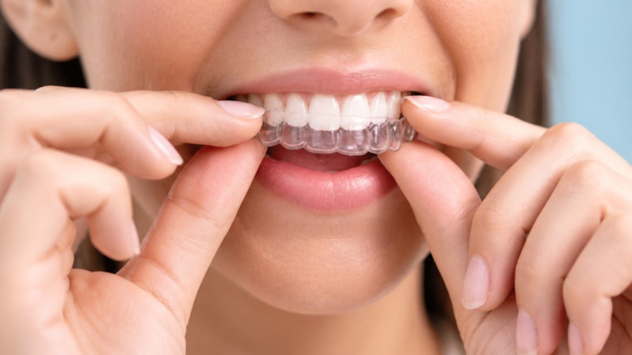 oral appliance sleep apnea treatment